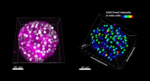 H3K27me3 beta-cell epigenetics visual